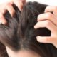 skin rashes itchy scalp
